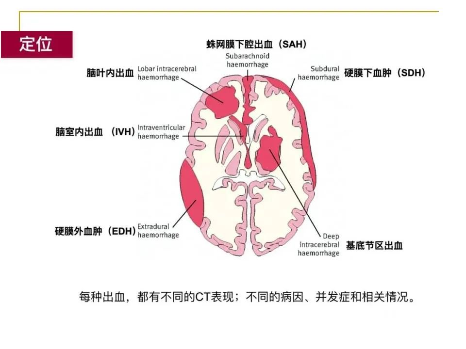 影像PPT - 【PPT】临床专业住院医师结业技能考核-14