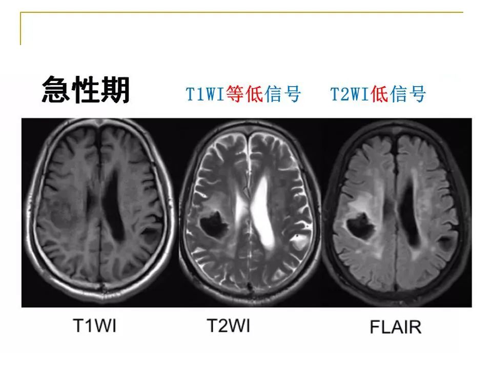 影像PPT - 【PPT】临床专业住院医师结业技能考核-16