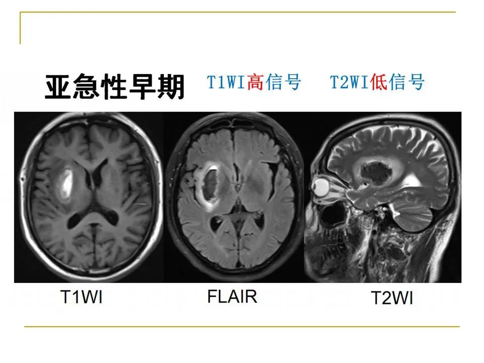 影像PPT - 【PPT】临床专业住院医师结业技能考核-17