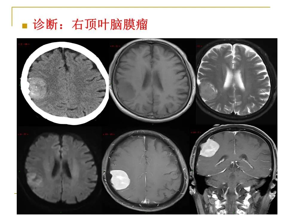 影像PPT - 【PPT】临床专业住院医师结业技能考核-29