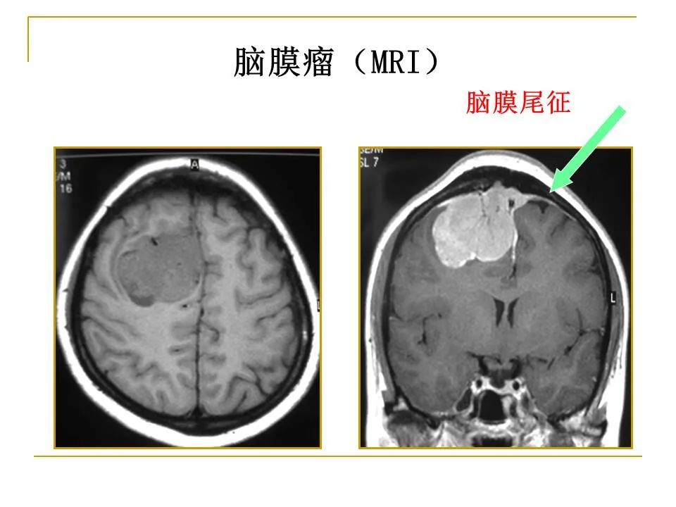 影像PPT - 【PPT】临床专业住院医师结业技能考核-30