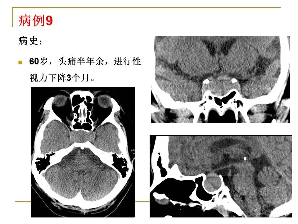 影像PPT - 【PPT】临床专业住院医师结业技能考核-31
