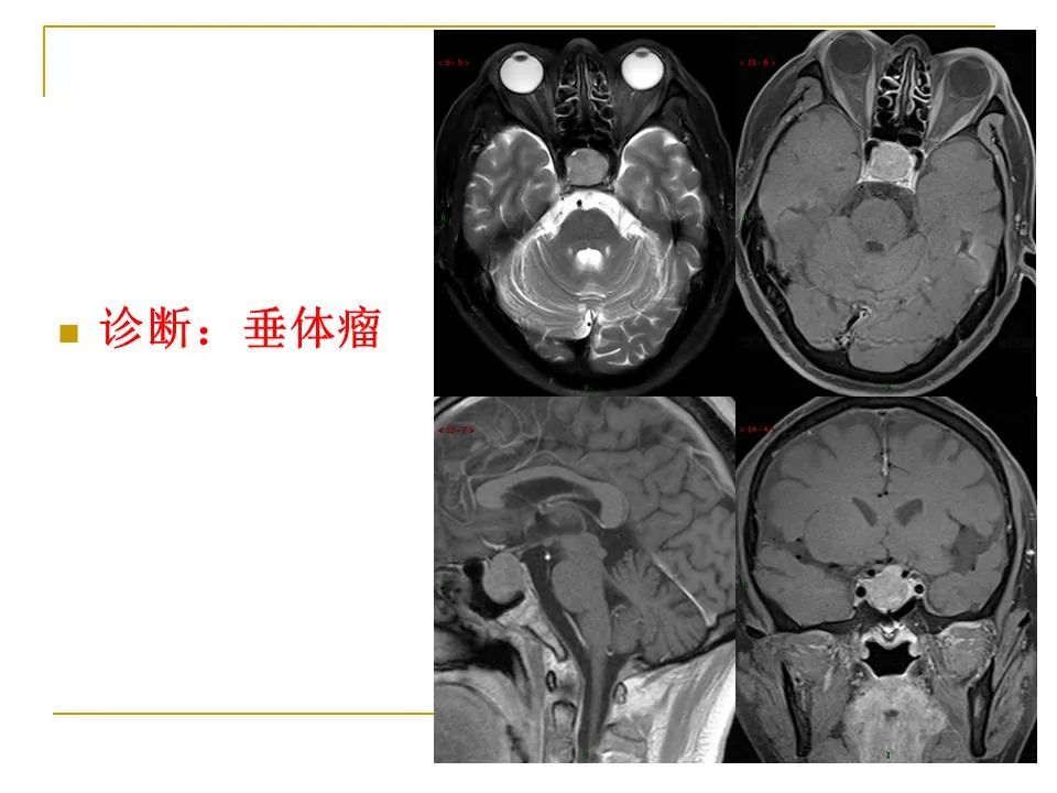 影像PPT - 【PPT】临床专业住院医师结业技能考核-32