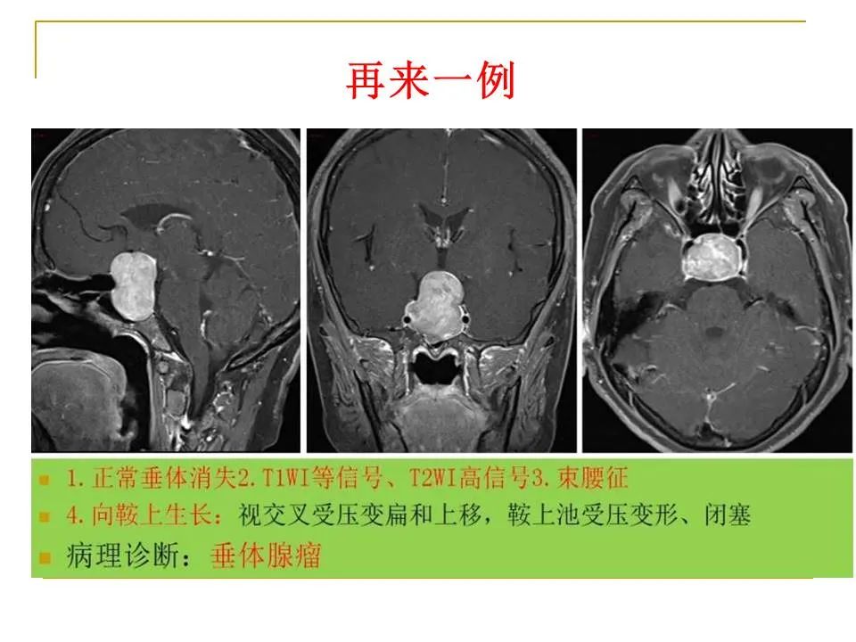 影像PPT - 【PPT】临床专业住院医师结业技能考核-33