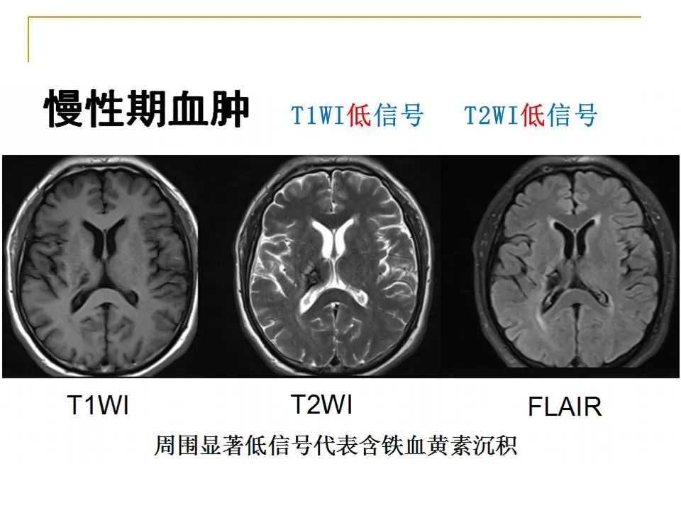 影像PPT - 【PPT】临床专业住院医师结业技能考核-19