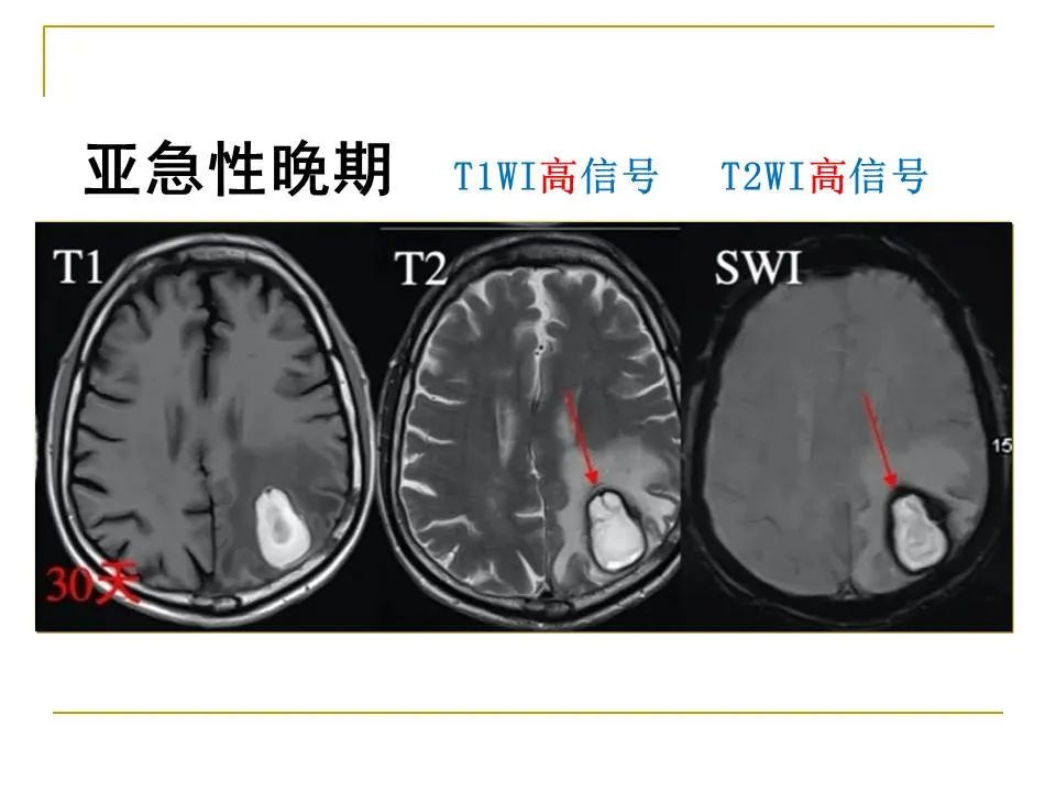 影像PPT - 【PPT】临床专业住院医师结业技能考核-18