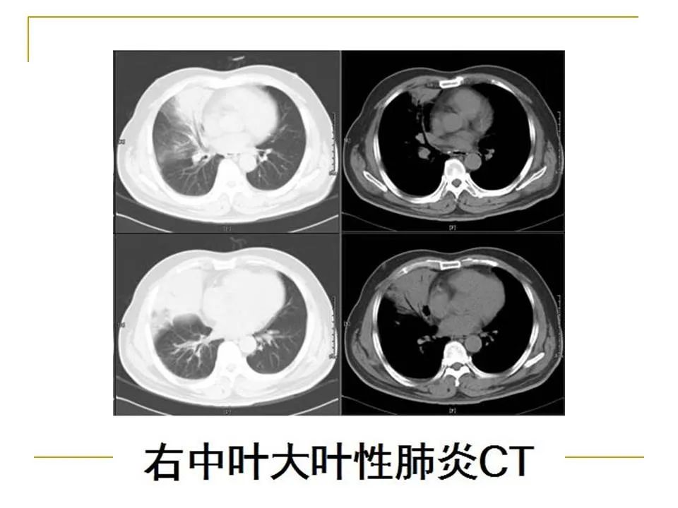 影像PPT - 【PPT】临床专业住院医师结业技能考核-40