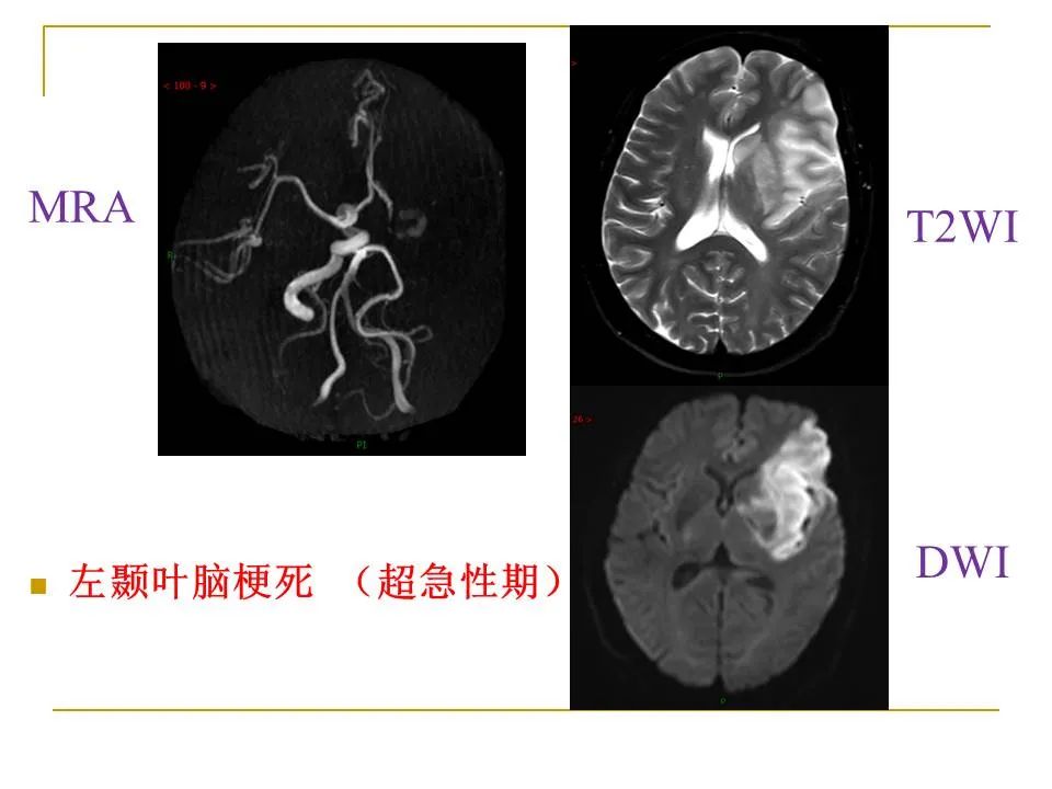 影像PPT - 【PPT】临床专业住院医师结业技能考核-25