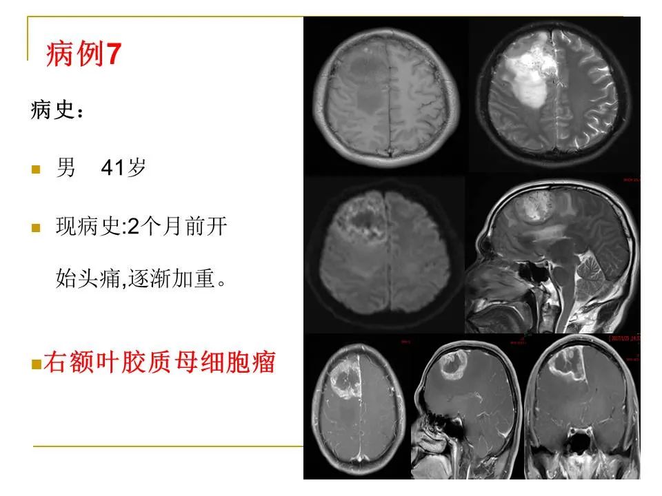影像PPT - 【PPT】临床专业住院医师结业技能考核-26