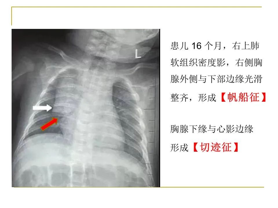影像PPT - 【PPT】临床专业住院医师结业技能考核-43