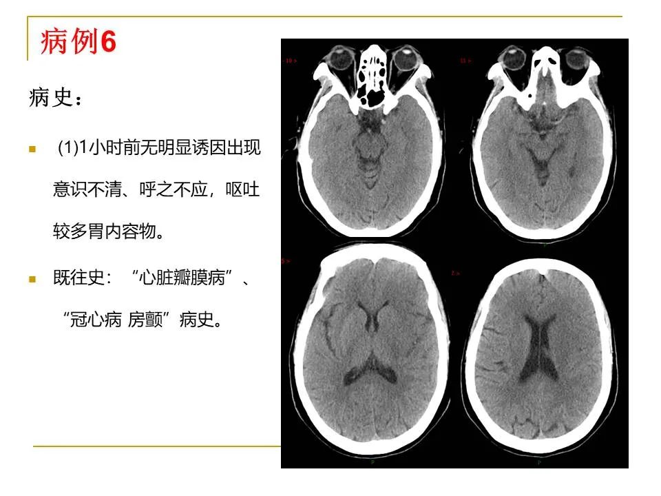 影像PPT - 【PPT】临床专业住院医师结业技能考核-24