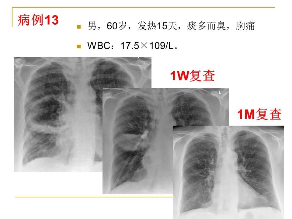 影像PPT - 【PPT】临床专业住院医师结业技能考核-50