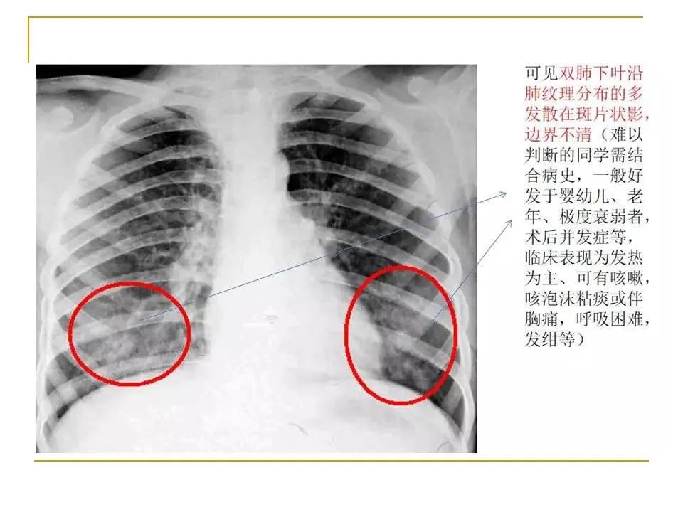影像PPT - 【PPT】临床专业住院医师结业技能考核-46