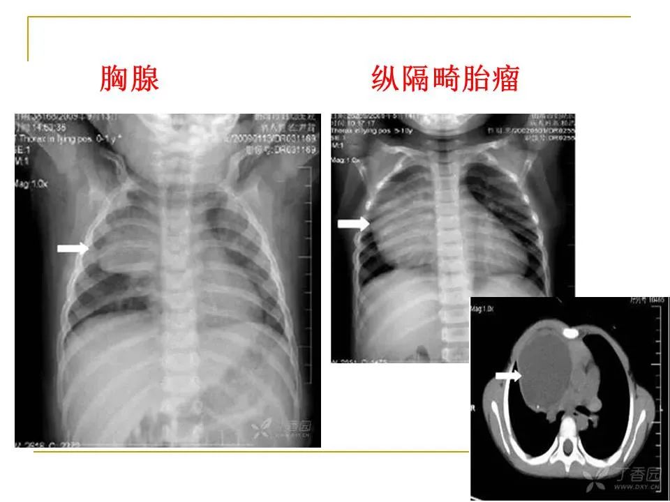 影像PPT - 【PPT】临床专业住院医师结业技能考核-44