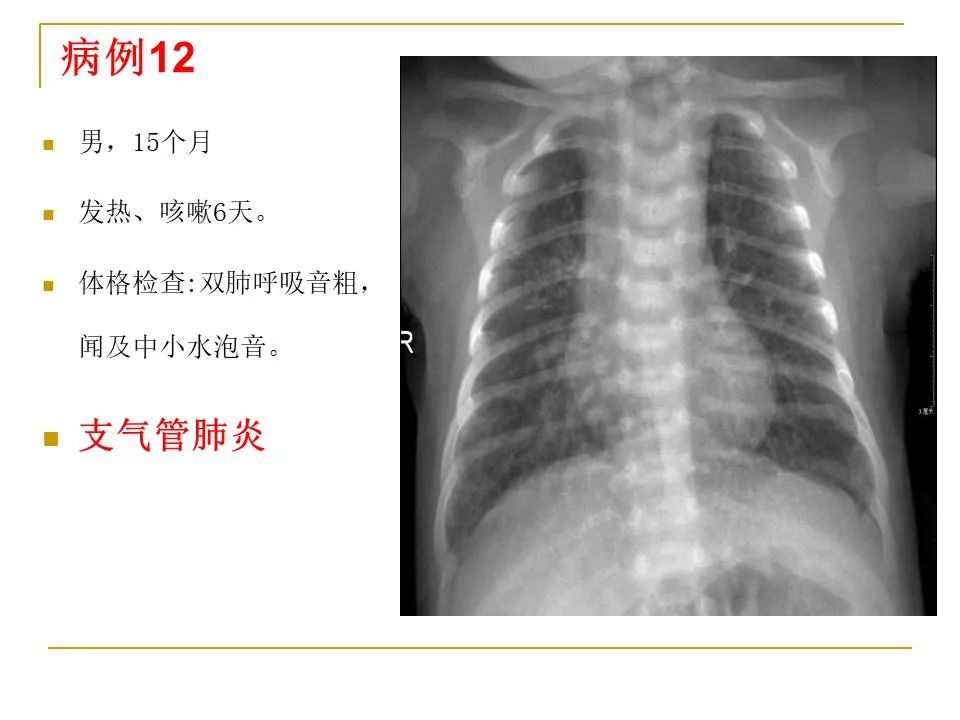 影像PPT - 【PPT】临床专业住院医师结业技能考核-45