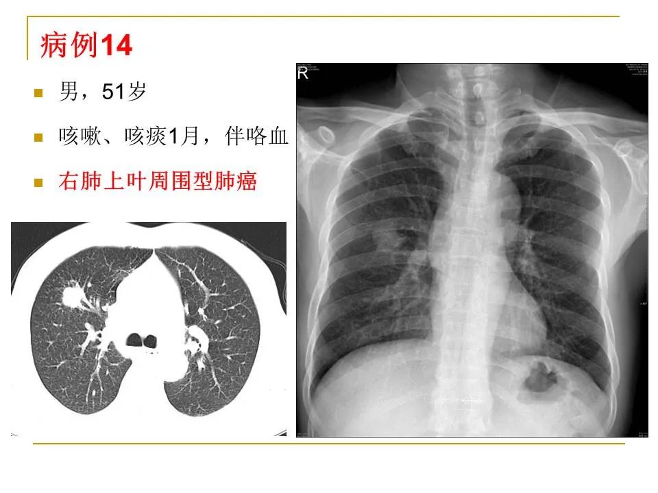 影像PPT - 【PPT】临床专业住院医师结业技能考核-53