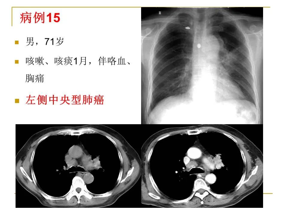 影像PPT - 【PPT】临床专业住院医师结业技能考核-55