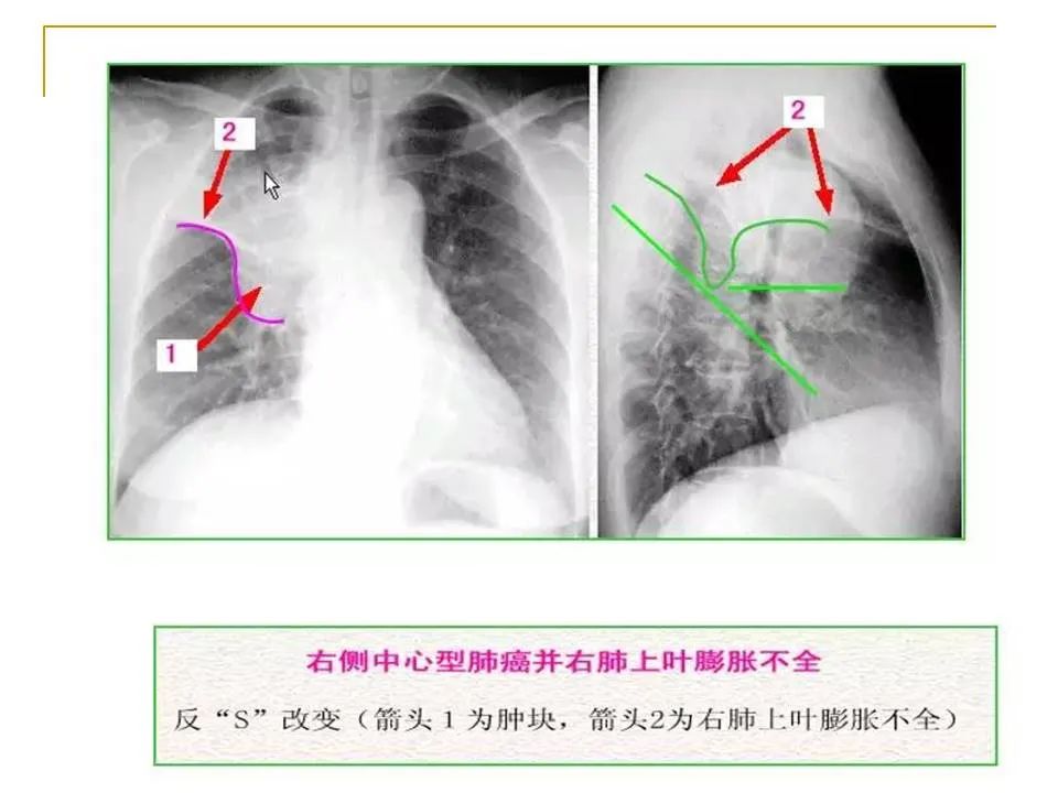 影像PPT - 【PPT】临床专业住院医师结业技能考核-56