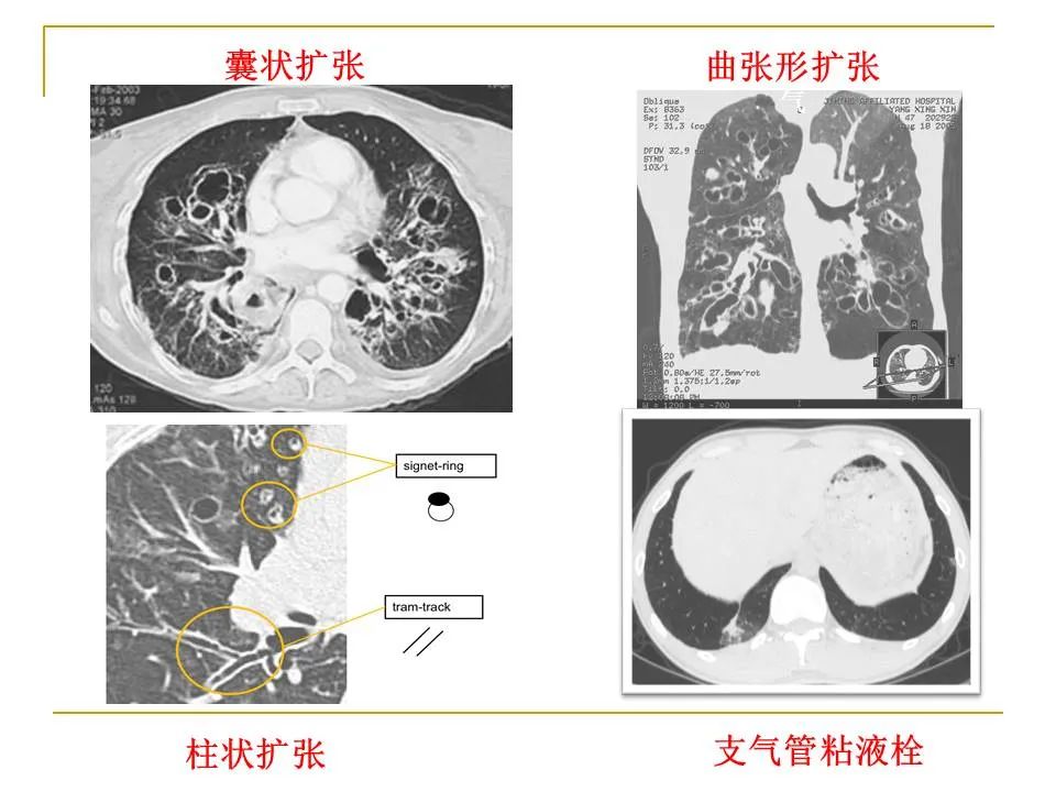 影像PPT - 【PPT】临床专业住院医师结业技能考核-59