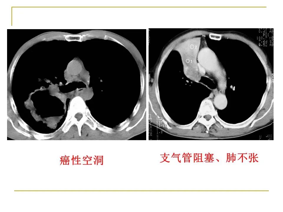 影像PPT - 【PPT】临床专业住院医师结业技能考核-57