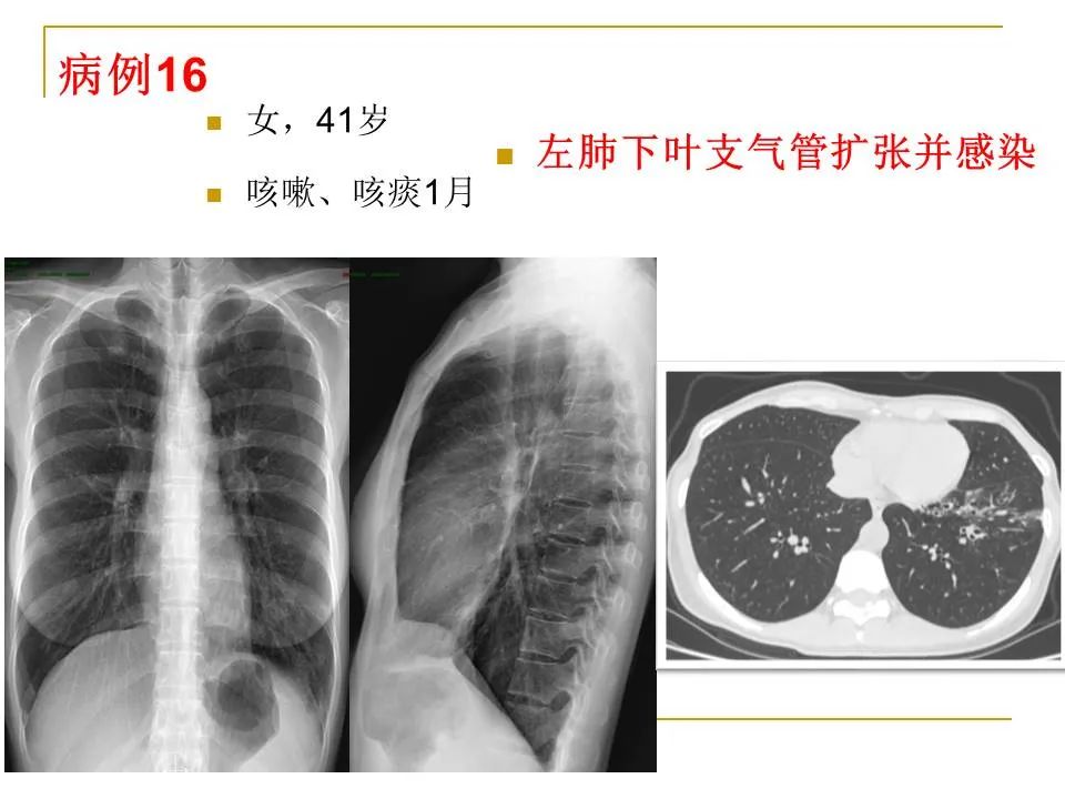 影像PPT - 【PPT】临床专业住院医师结业技能考核-58