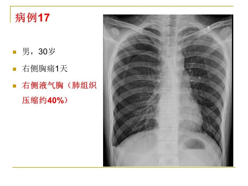 影像PPT - 【PPT】临床专业住院医师结业技能考核-60