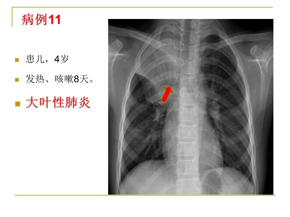 影像PPT - 【PPT】临床专业住院医师结业技能考核-39