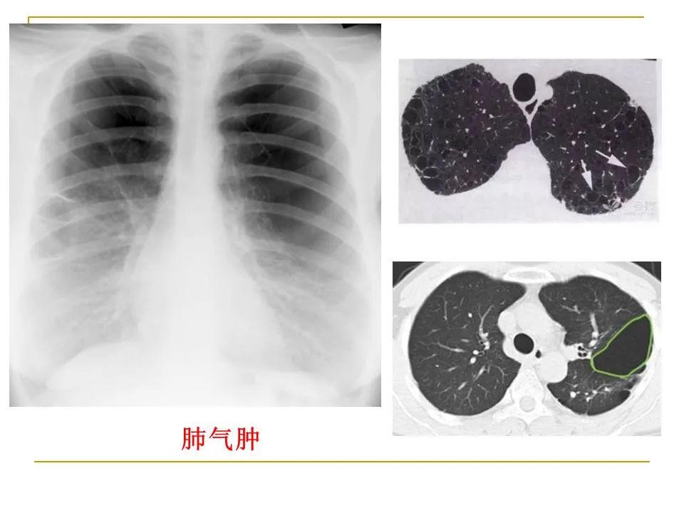影像PPT - 【PPT】临床专业住院医师结业技能考核-62