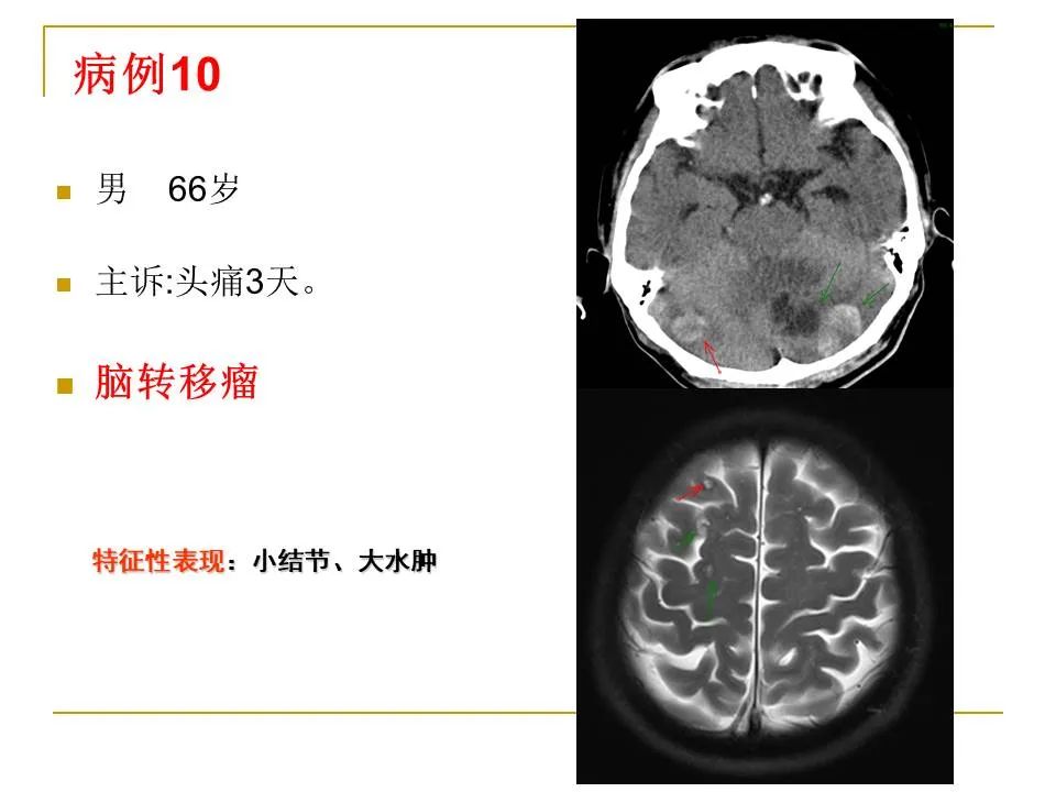 影像PPT - 【PPT】临床专业住院医师结业技能考核-35