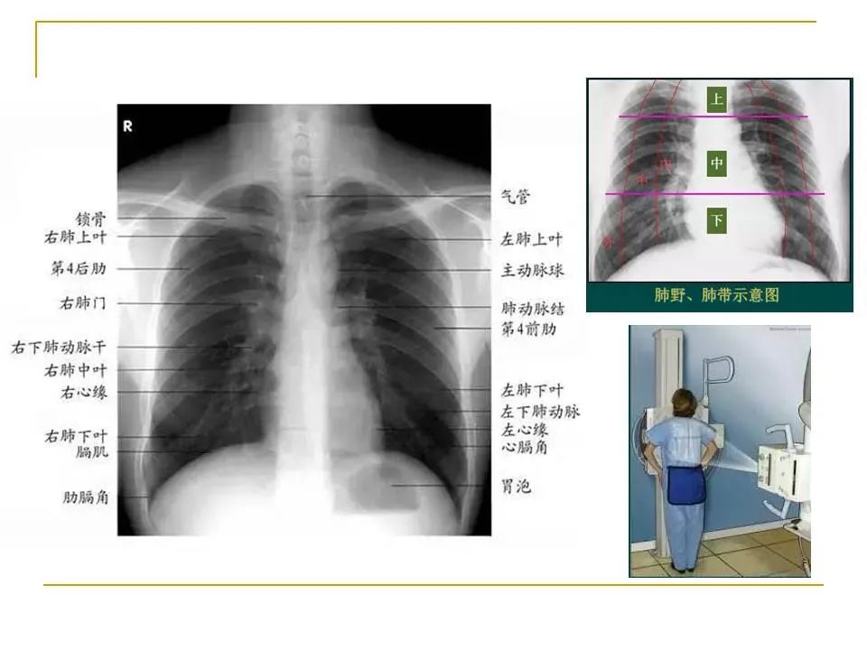 影像PPT - 【PPT】临床专业住院医师结业技能考核-37