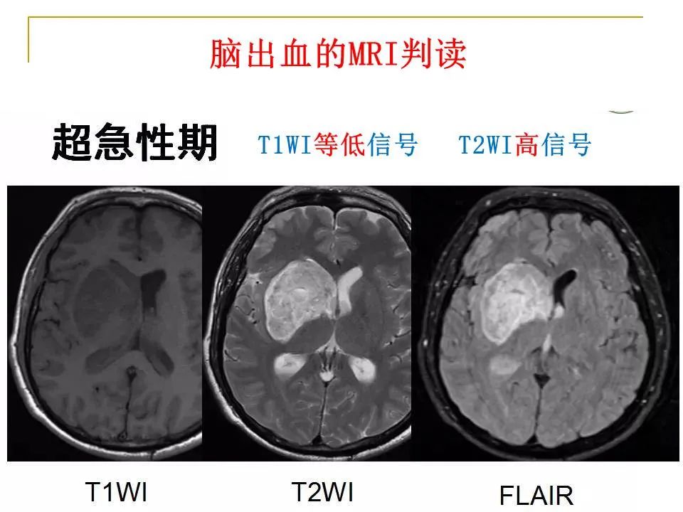 影像PPT - 【PPT】临床专业住院医师结业技能考核-15
