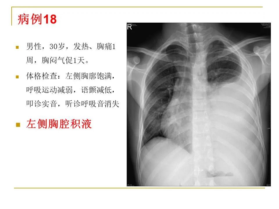 影像PPT - 【PPT】临床专业住院医师结业技能考核-63