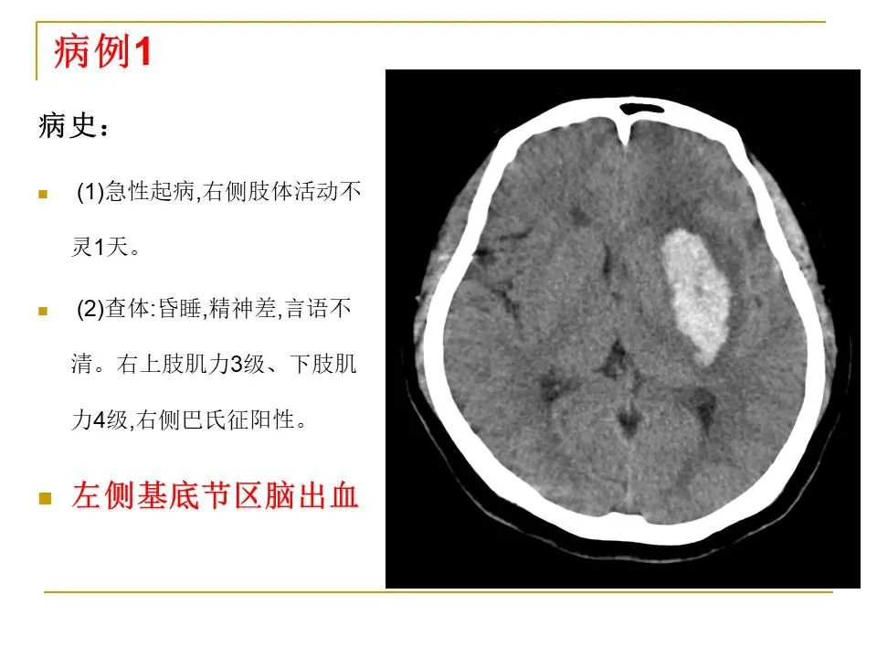 影像PPT - 【PPT】临床专业住院医师结业技能考核-5