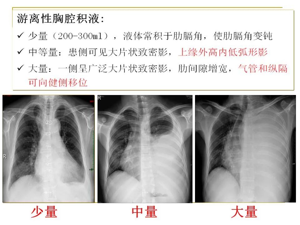 影像PPT - 【PPT】临床专业住院医师结业技能考核-64