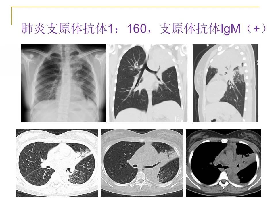 影像PPT - 【PPT】临床专业住院医师结业技能考核-47
