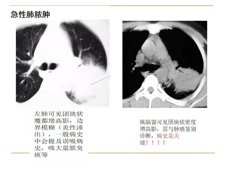 影像PPT - 【PPT】临床专业住院医师结业技能考核-51