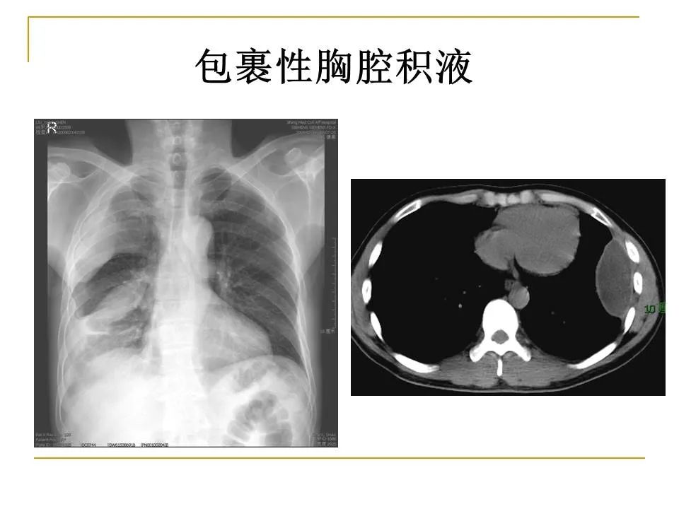 影像PPT - 【PPT】临床专业住院医师结业技能考核-65