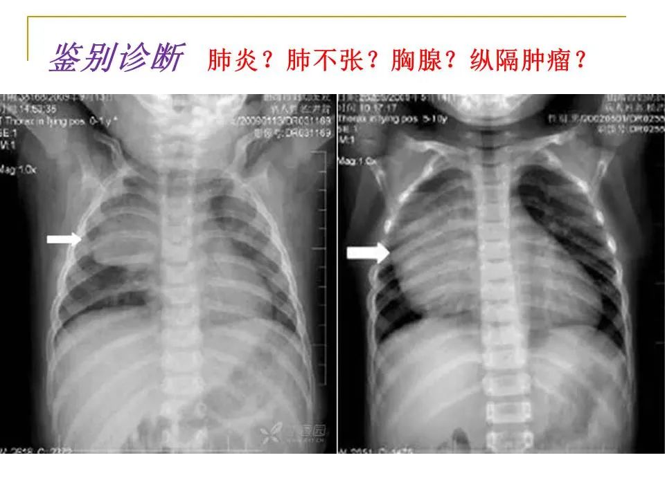 影像PPT - 【PPT】临床专业住院医师结业技能考核-42
