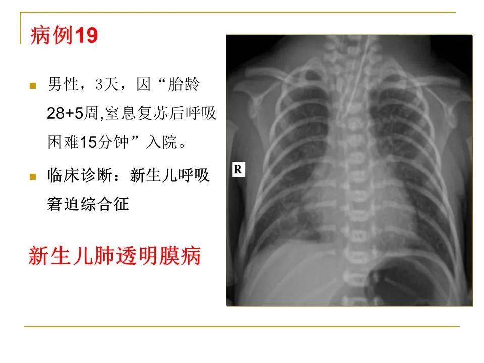 影像PPT - 【PPT】临床专业住院医师结业技能考核-66