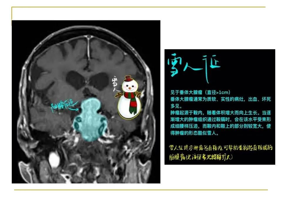 影像PPT - 【PPT】临床专业住院医师结业技能考核-34