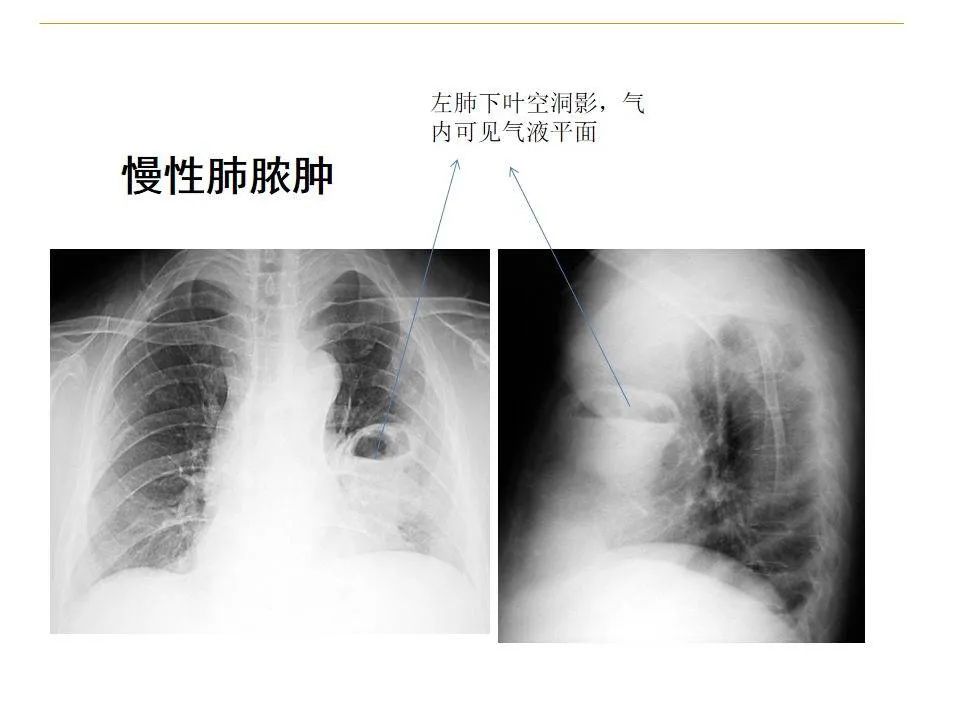 影像PPT - 【PPT】临床专业住院医师结业技能考核-52