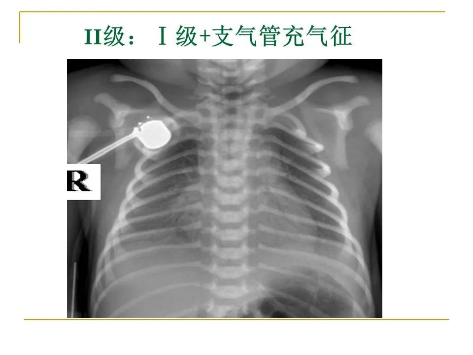 影像PPT - 【PPT】临床专业住院医师结业技能考核-68
