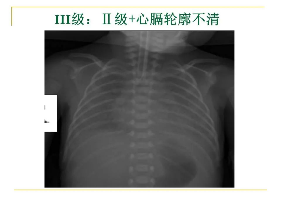 影像PPT - 【PPT】临床专业住院医师结业技能考核-69