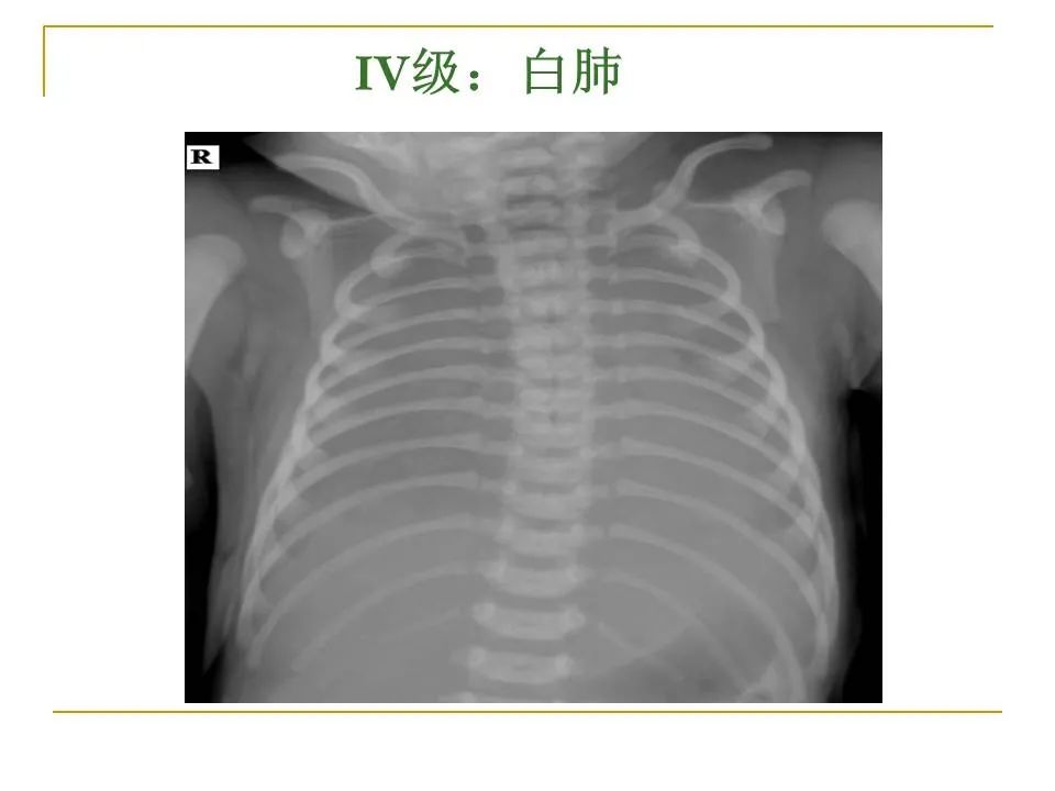 影像PPT - 【PPT】临床专业住院医师结业技能考核-70