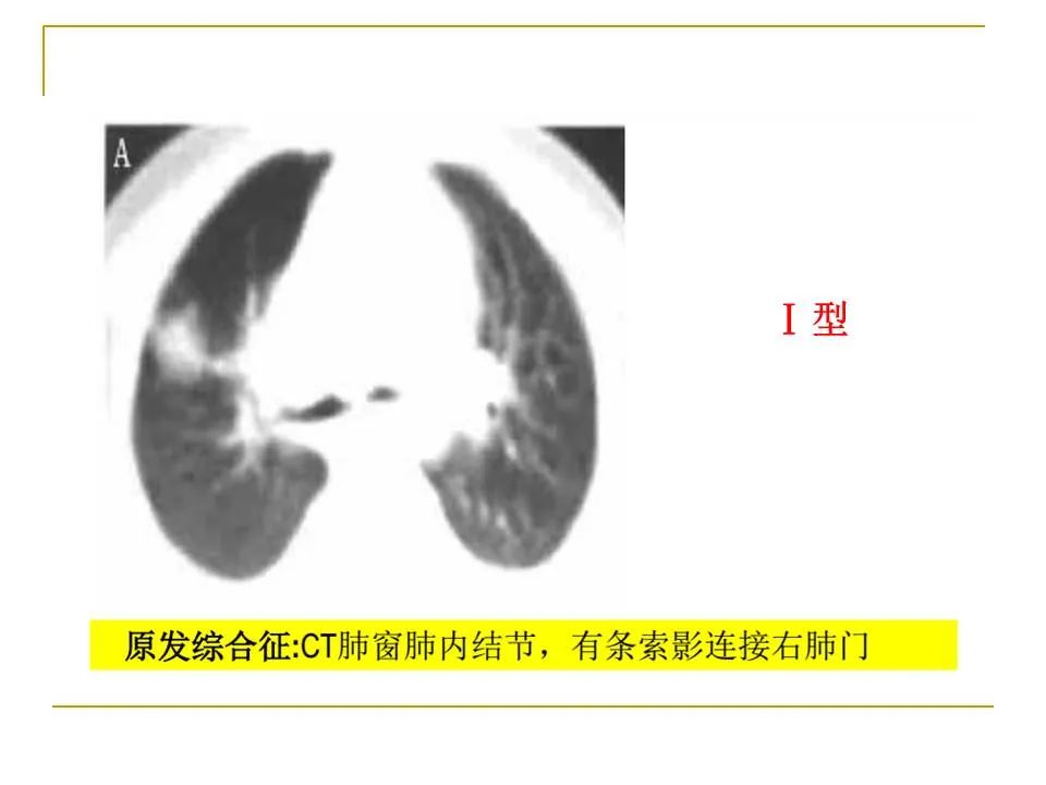 影像PPT - 【PPT】临床专业住院医师结业技能考核-73