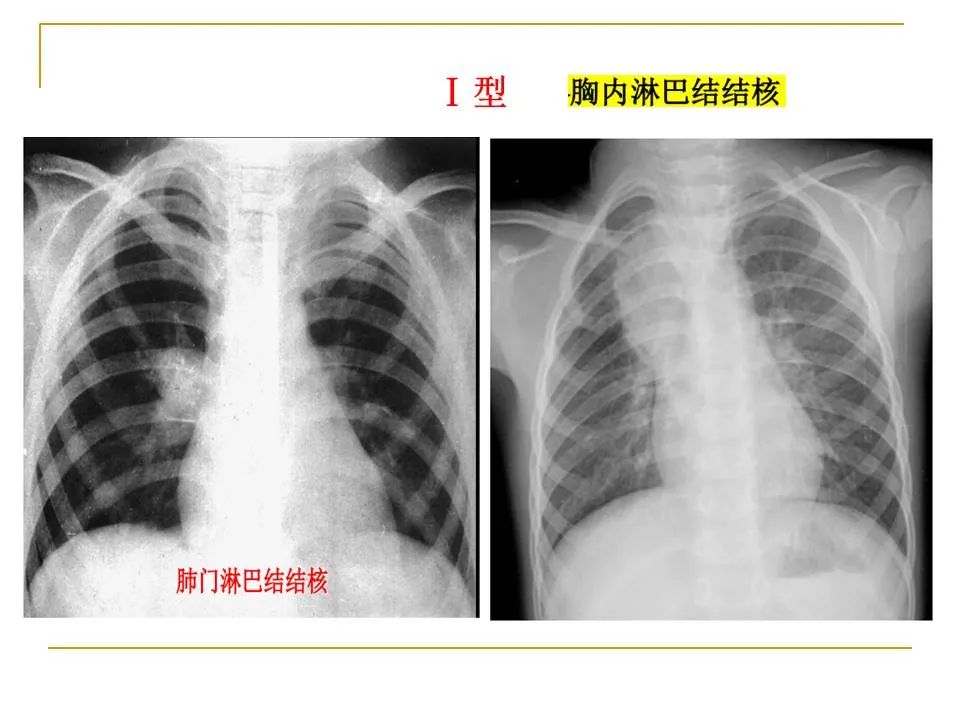 影像PPT - 【PPT】临床专业住院医师结业技能考核-74