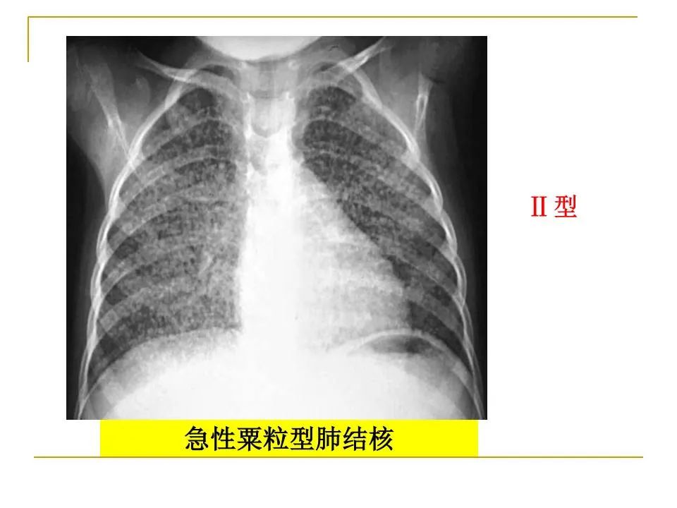 影像PPT - 【PPT】临床专业住院医师结业技能考核-75