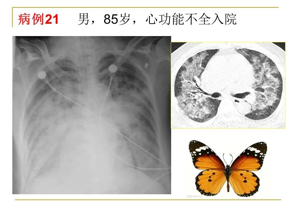 影像PPT - 【PPT】临床专业住院医师结业技能考核-77