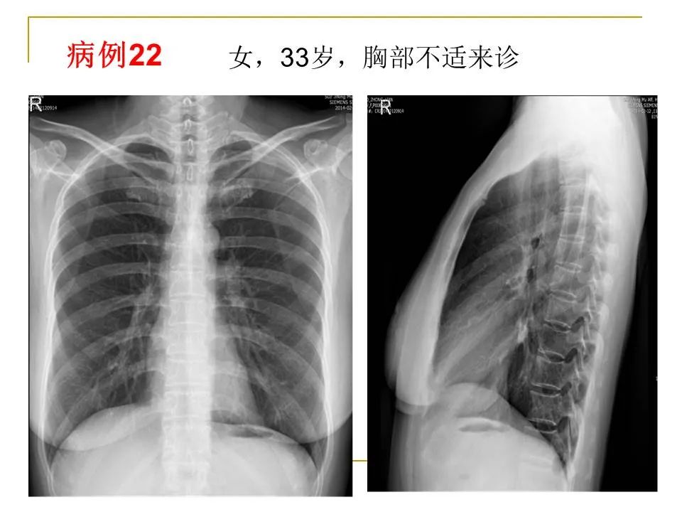 影像PPT - 【PPT】临床专业住院医师结业技能考核-78