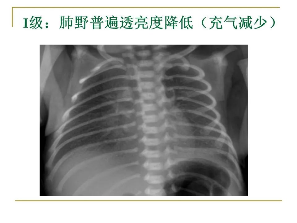 影像PPT - 【PPT】临床专业住院医师结业技能考核-67